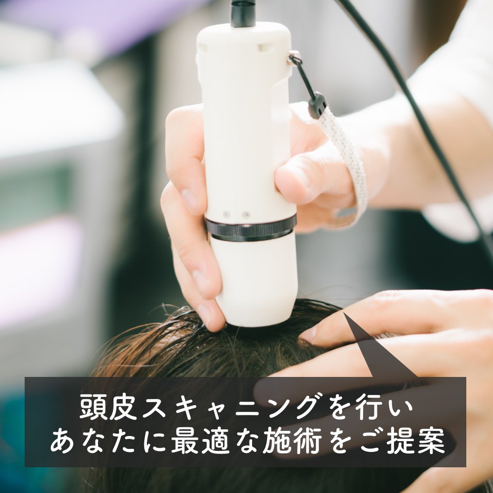 都城市の予防美容サロンで行う頭皮スキャニング診断