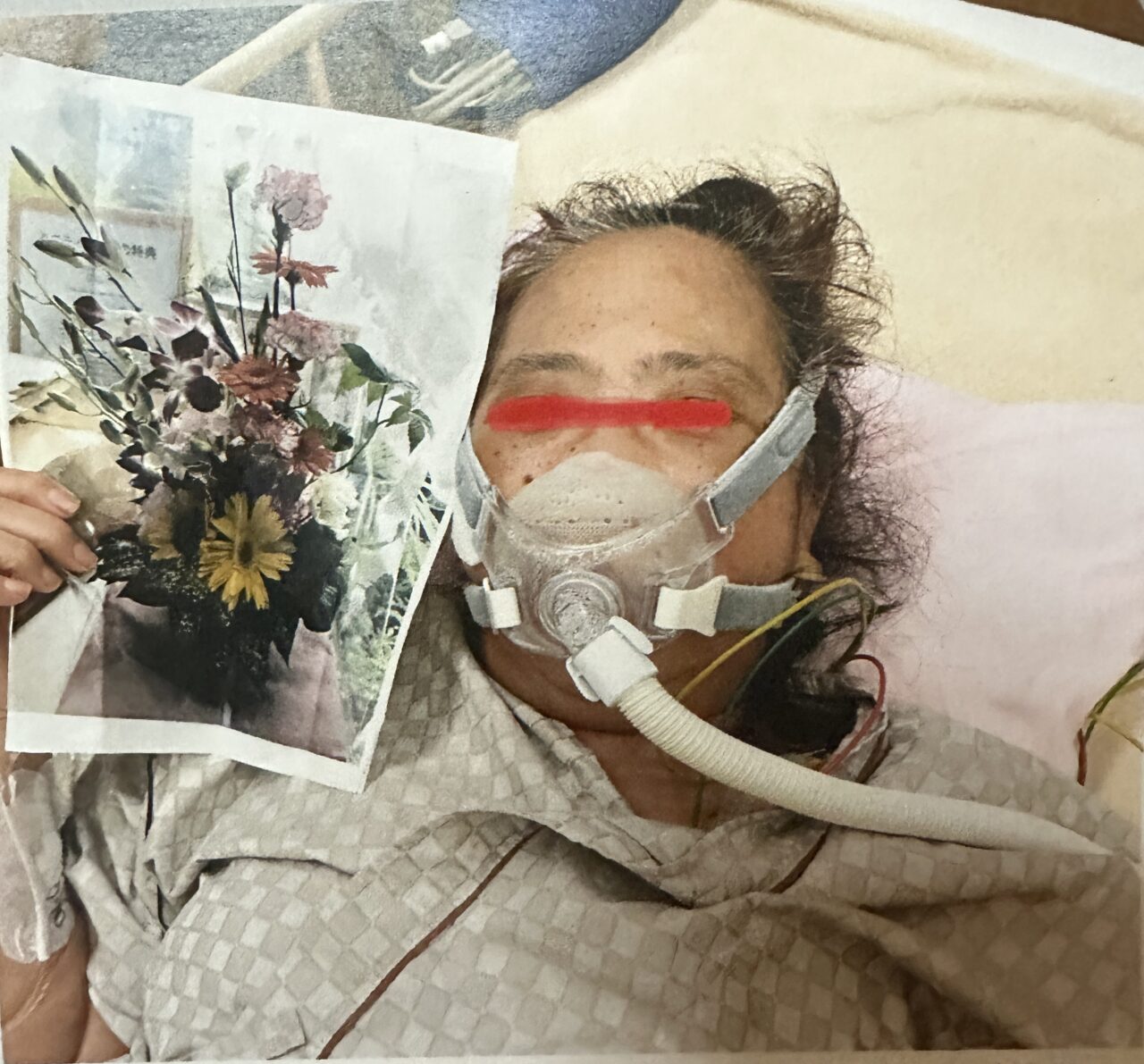曽於市｜70代女性｜頭皮ケアで見た目の印象が変化した事例before