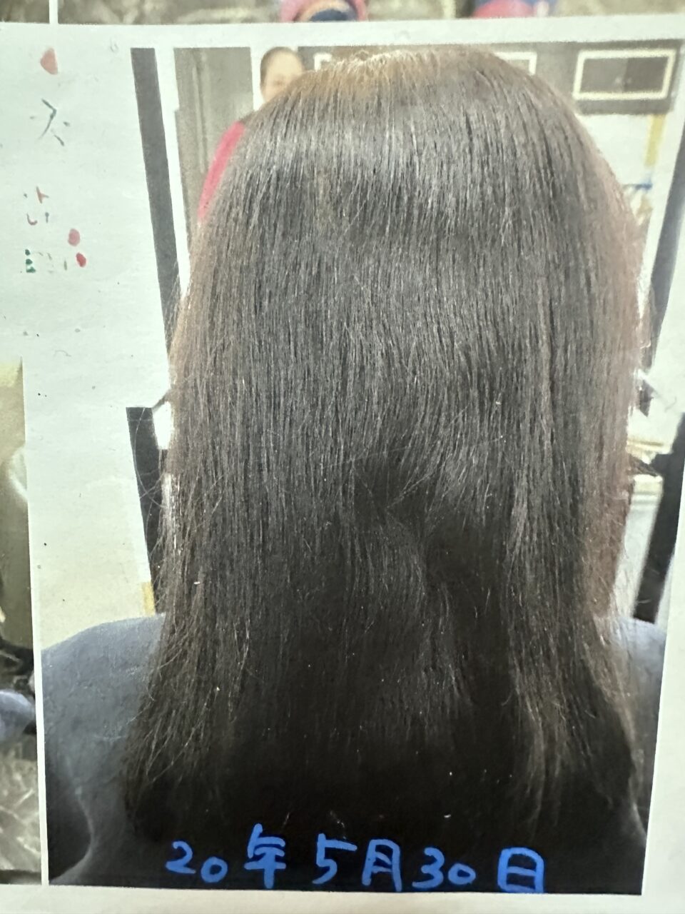 70代女性のボリューム感のお悩みと頭皮ケア事例