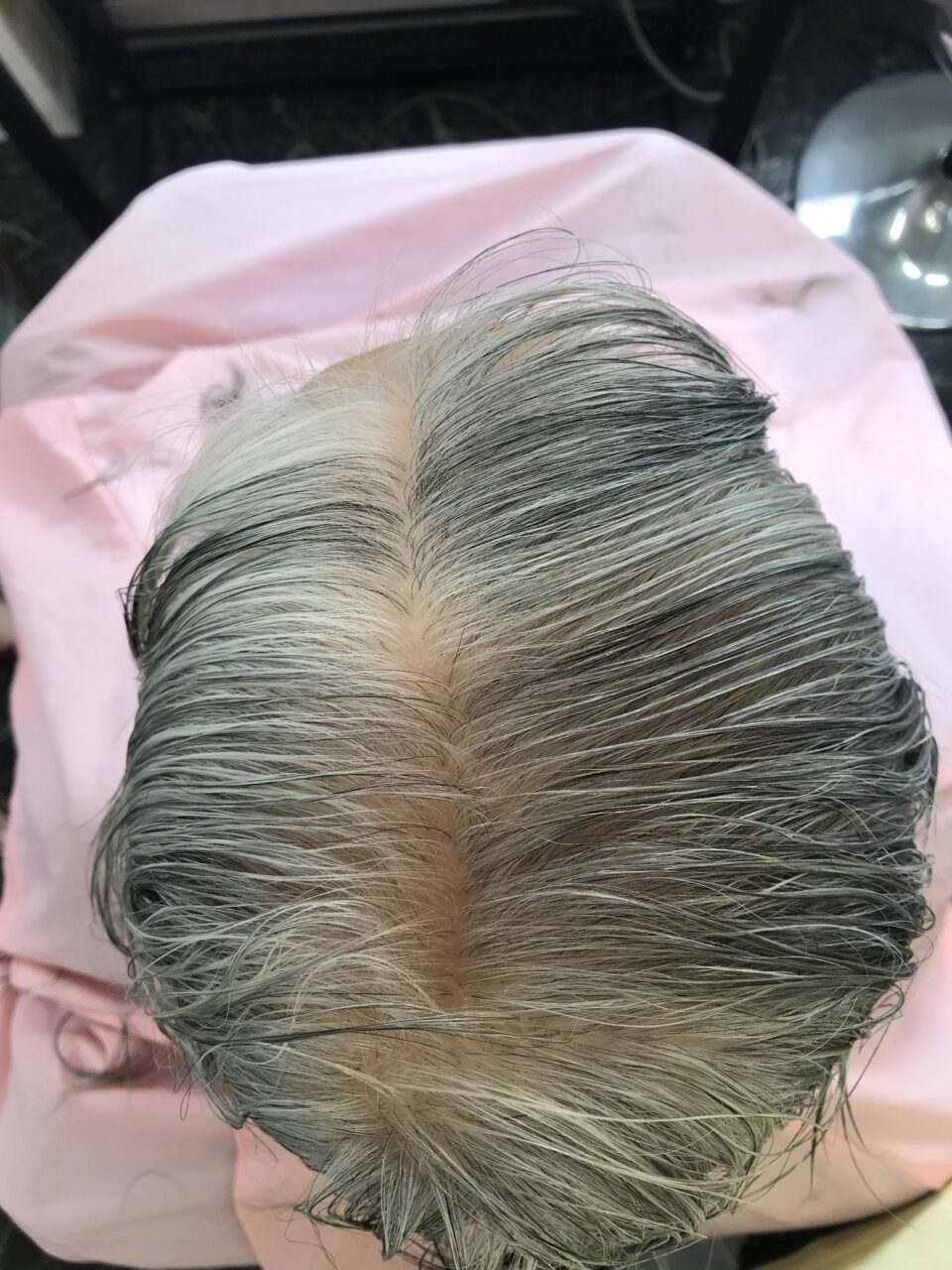 曽於市｜80代女性｜白髪とグレーヘアーへ移行中の頭皮ケア事例after