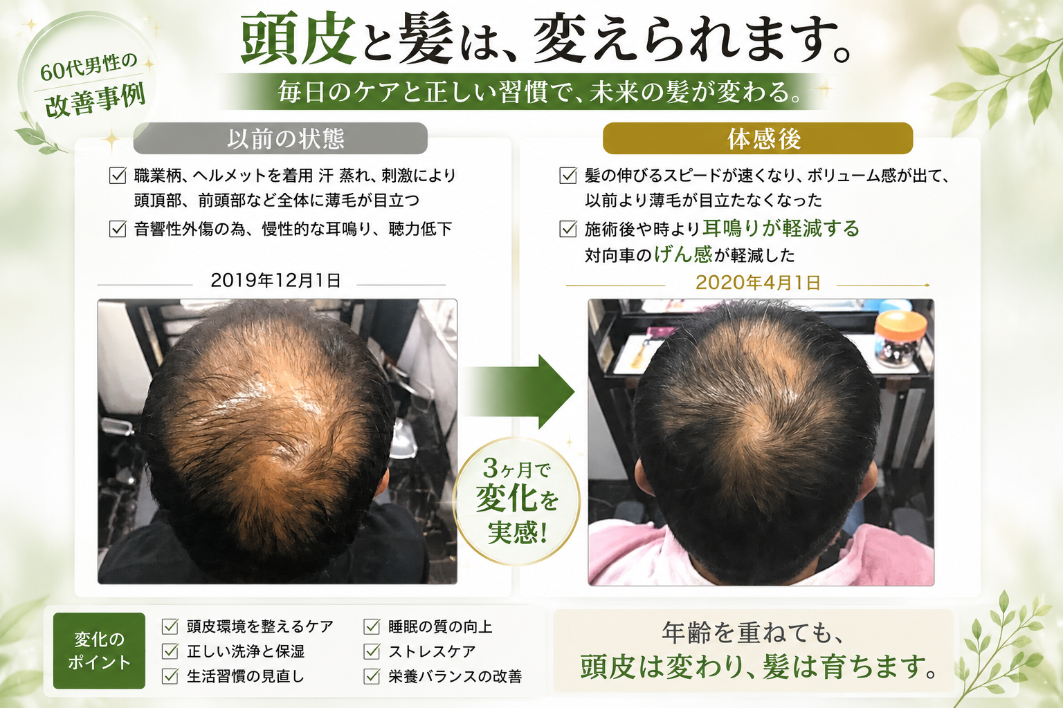 60代男性の頭頂部の頭皮環境とボリューム感の変化事例