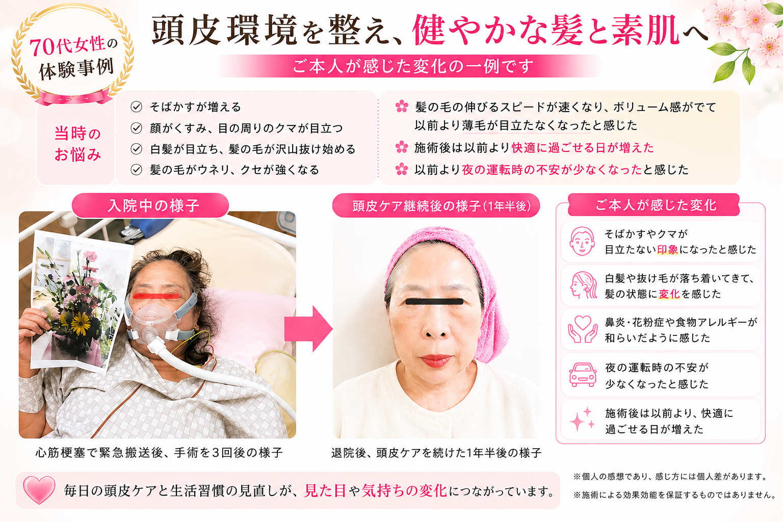 頭皮ケア継続後の70代女性の髪や見た目の印象変化事例