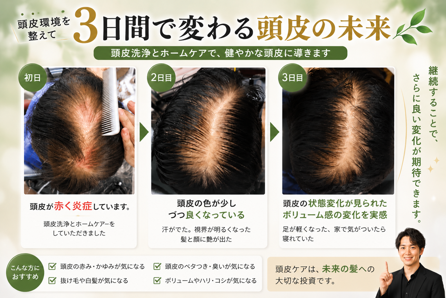 頭皮洗浄によるボリュームケア改善事例
