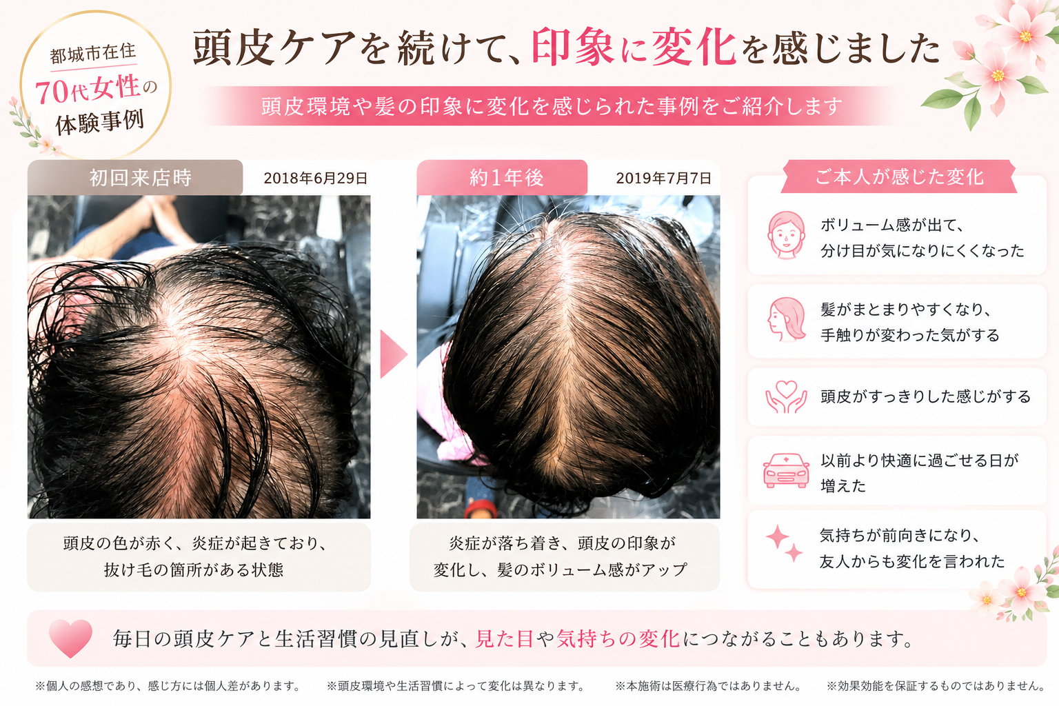 70代女性の分け目やボリューム低下が気になる来店時の頭皮状態 頭皮ケア継続後の70代女性の髪のボリューム感と分け目の印象